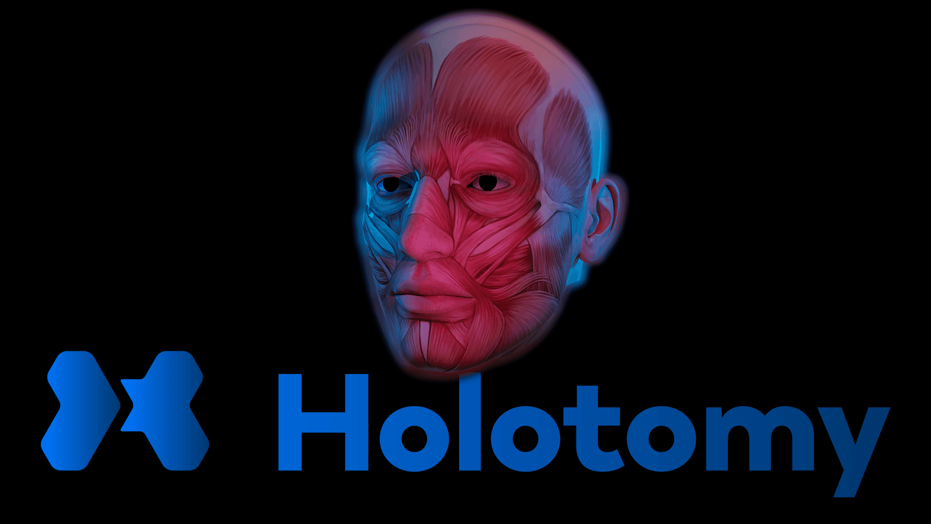 Holotomy
